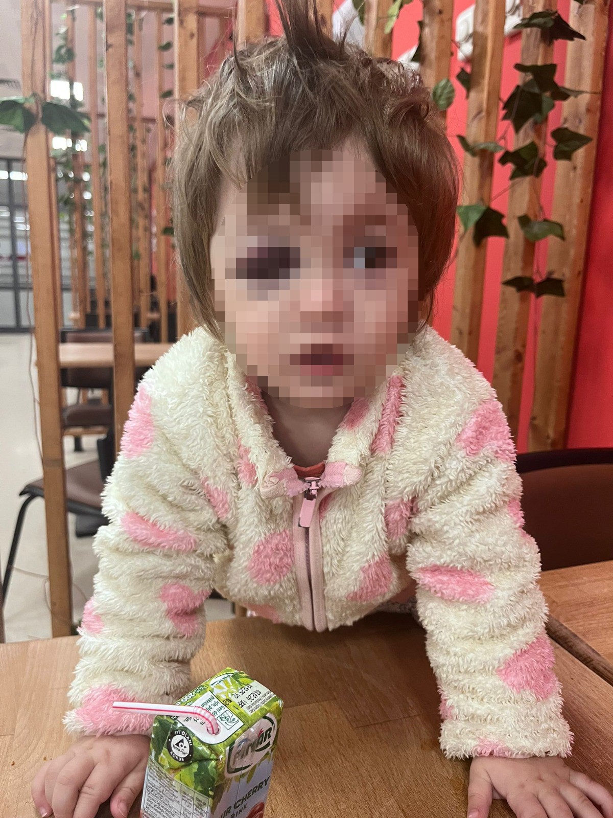 Yalova’da Komşu Kavgasında Yaralanan 14 Aylık Bebek Taburcu Edildi (3)