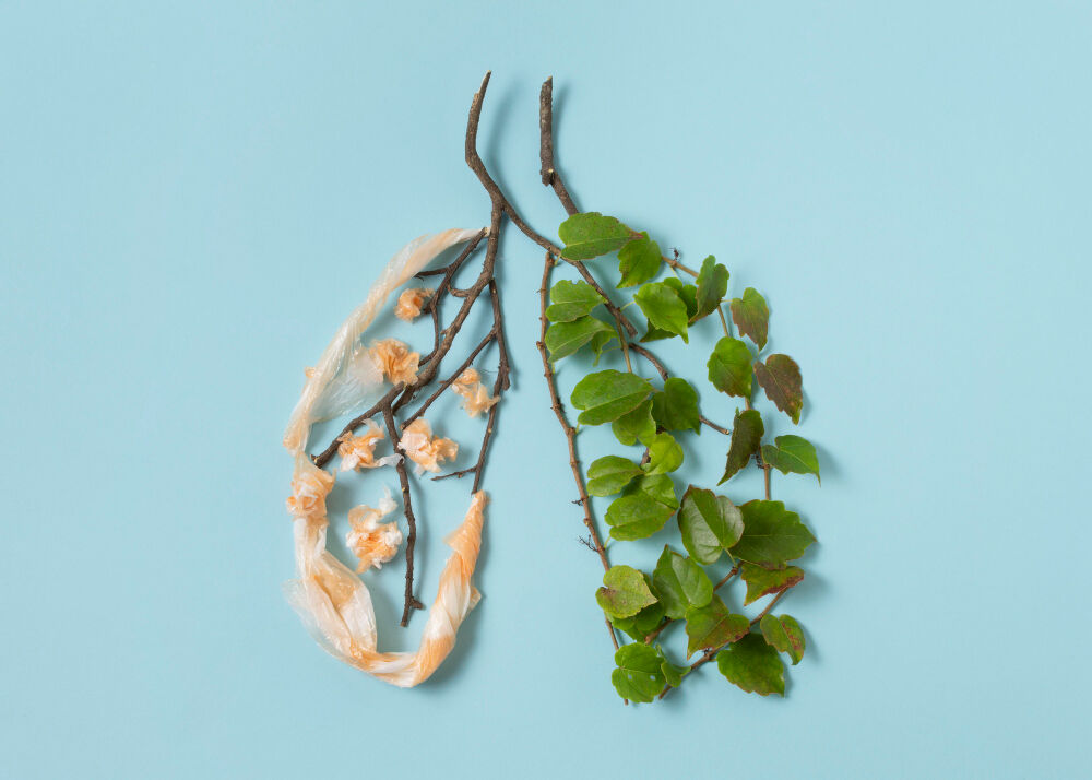 Dünya Tüberküloz Verem Günü 24 Mart Ne Günü Gençgazete (2)