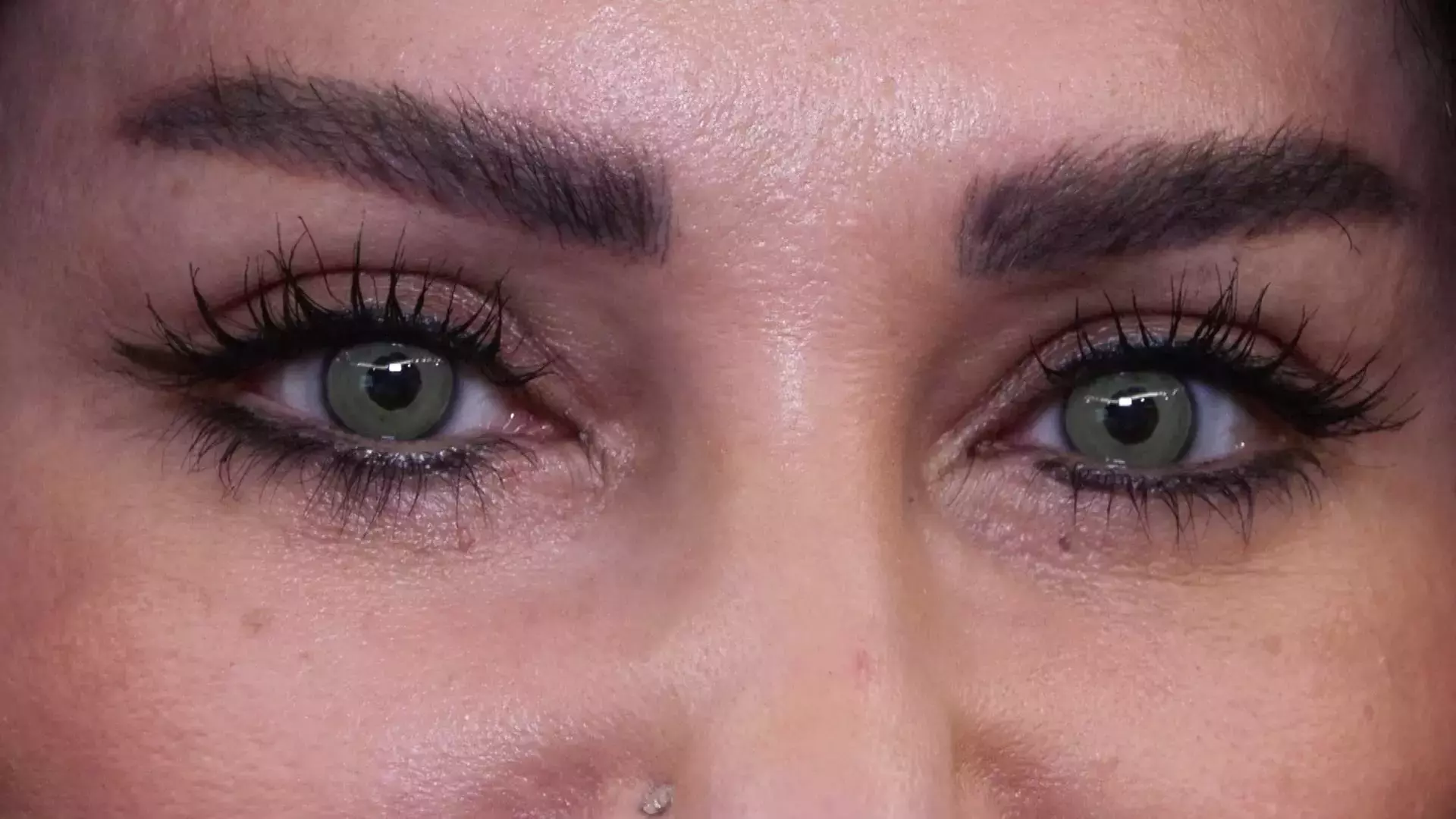 Göz Rengi Değiştirmek Mümkün Mü Göz Rengi Değiştirme Ameliyatı Nasıl Yapılıyor Ve Kalıcı Mı (1)