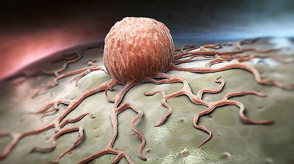 Kanser Riskini Azaltmak Mümkün Mü Uzmanlara Göre Günlük Hayatta Yapılabilecek 10 Önemli Alışkanlık! (2)-1