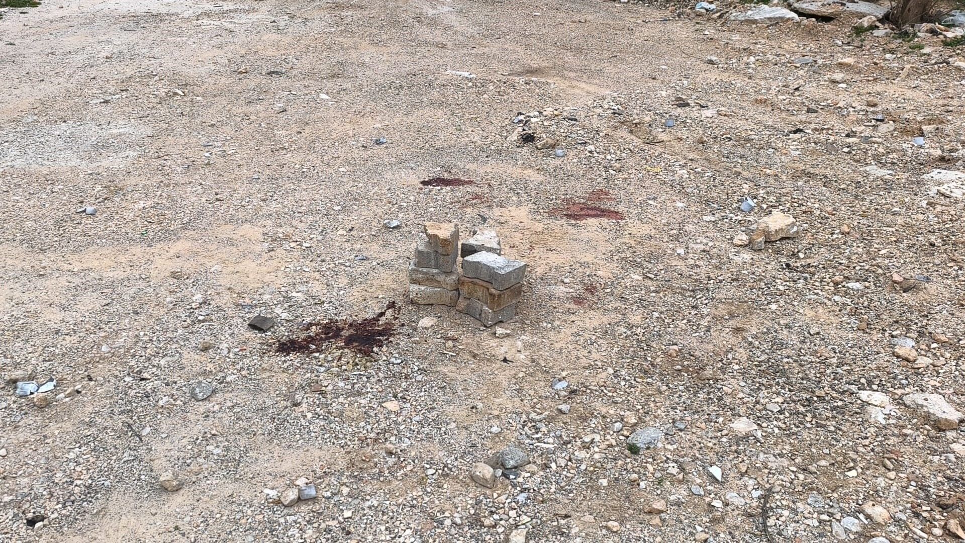 Muğla'da Ramazan Topu Patlamasında 19 Yaşındaki Genç Ağır Yaralandı (2)