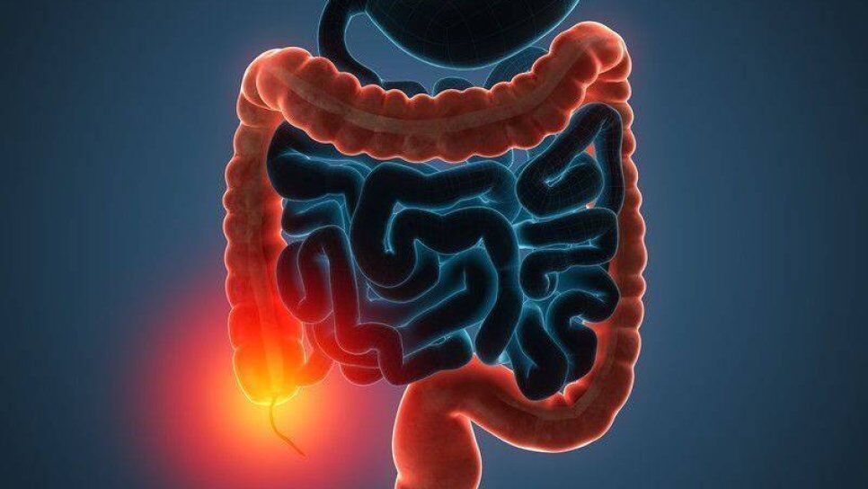 Tıpta Kolorektal Kanser (2)