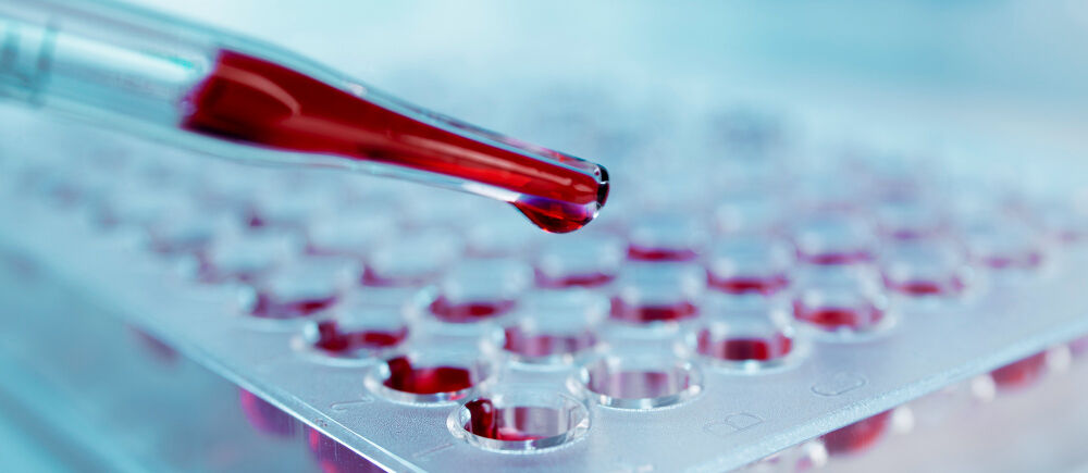 17 Nisan Ne Günü Dünya Hemofi̇li̇ Kan Gençgazete (10)