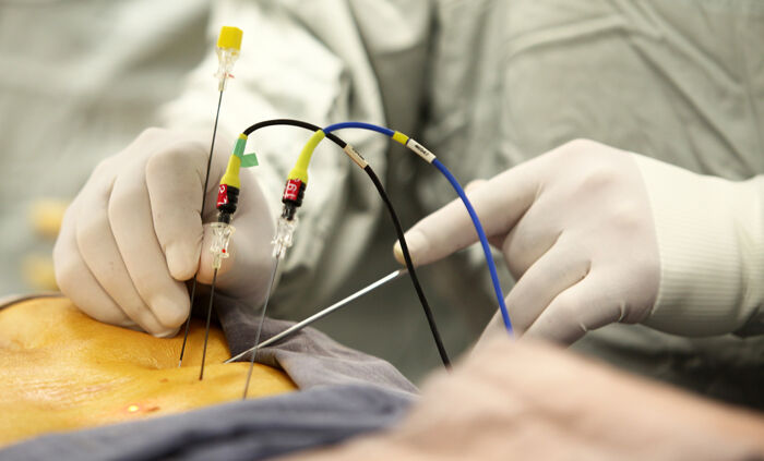 Ameliyatsız Bel Ve Boyun Fıtığı Tedavisi Mümkün Mü İşte Merak Edilen Gerçekler (1)