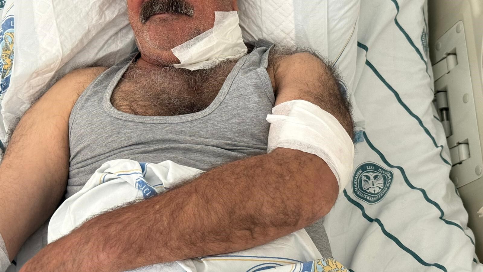 At Sahibini Boğazından Isırarak Ağır Yaraladı (2)