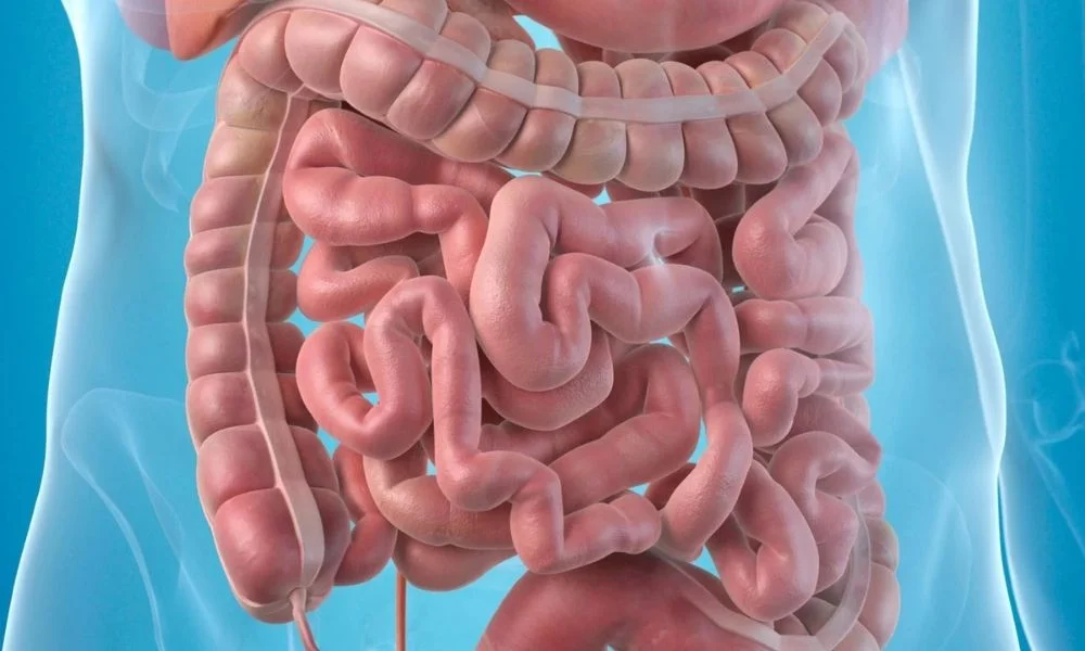 Bağırsak Düğümlenmesi Nedir, Neden Olur Ve Belirtileri Nelerdir Hayatı Tehdit Edebilir Mi (3)