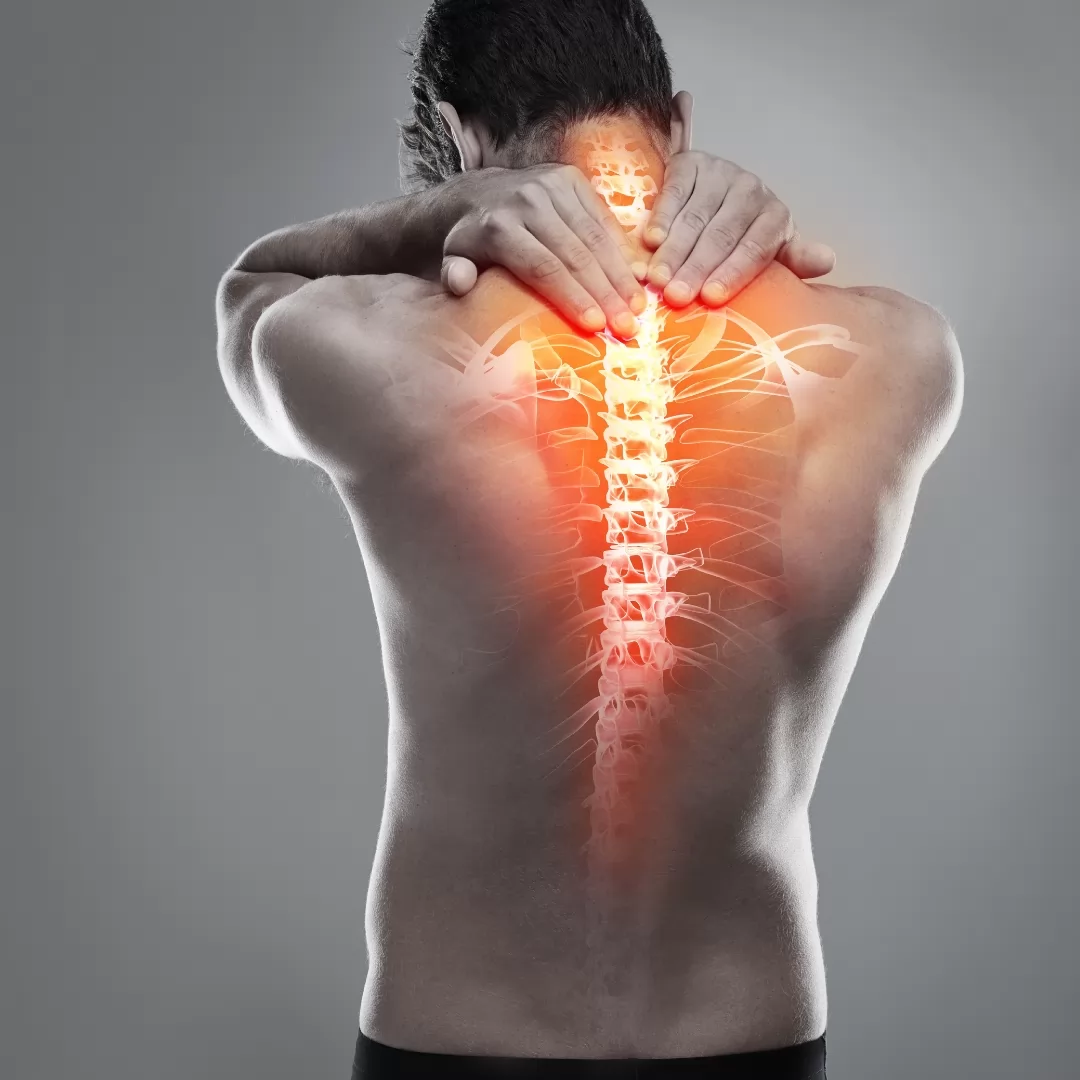 Bir Anda Boyun Tutulması Ve Sırt Ağrısı Neden Olur “Yel Girmesi” Nedir, Nasıl Geçer