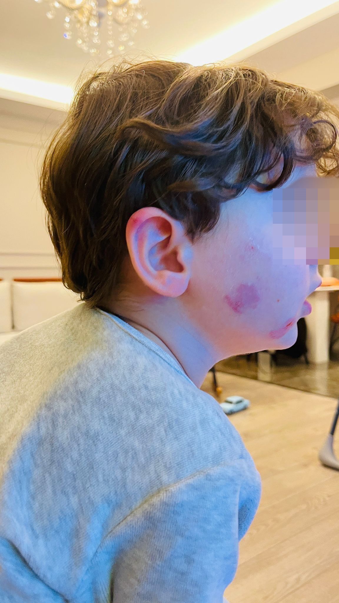 Bursa'da Kreşe Bıraktığı Çocuğunu Darp Edilmiş Halde Aldı (3)