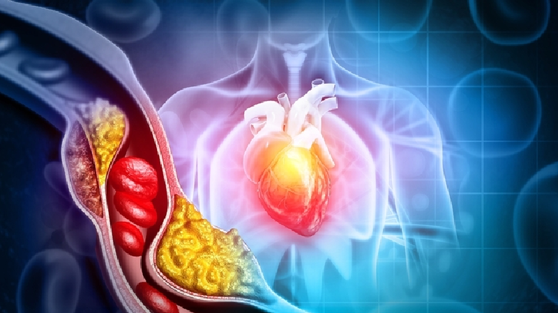 İyi Ve Kötü Kolesterol Arasındaki Fark Nedir, Hangisi Sessizce Damarları Tıkıyor (1)-2