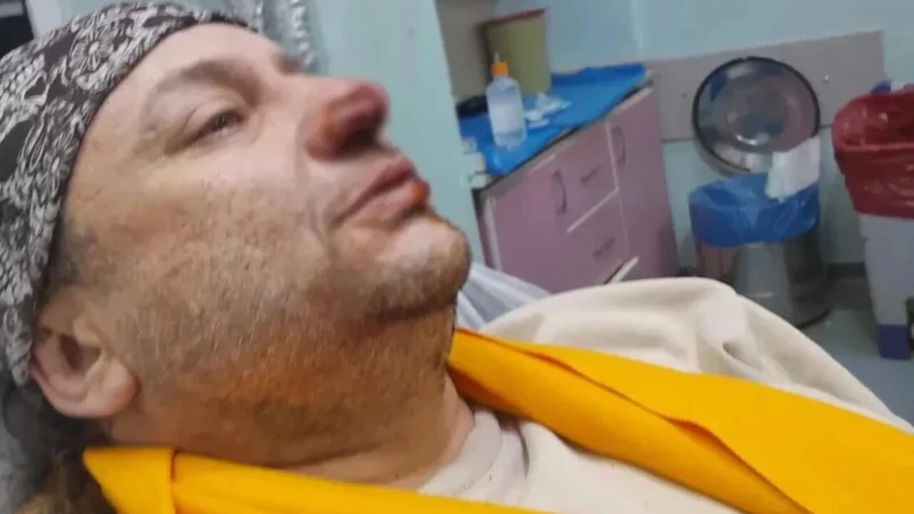 Onur Akay Pitbull Saldırısı Sonrası Entübe Edildi (1)