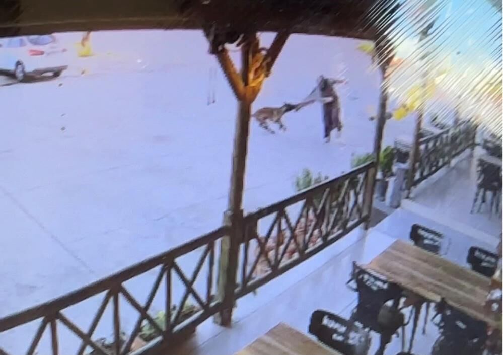 Tekmelere Aldırmayan Köepk Kadının Kolunu Kopardı! (3)
