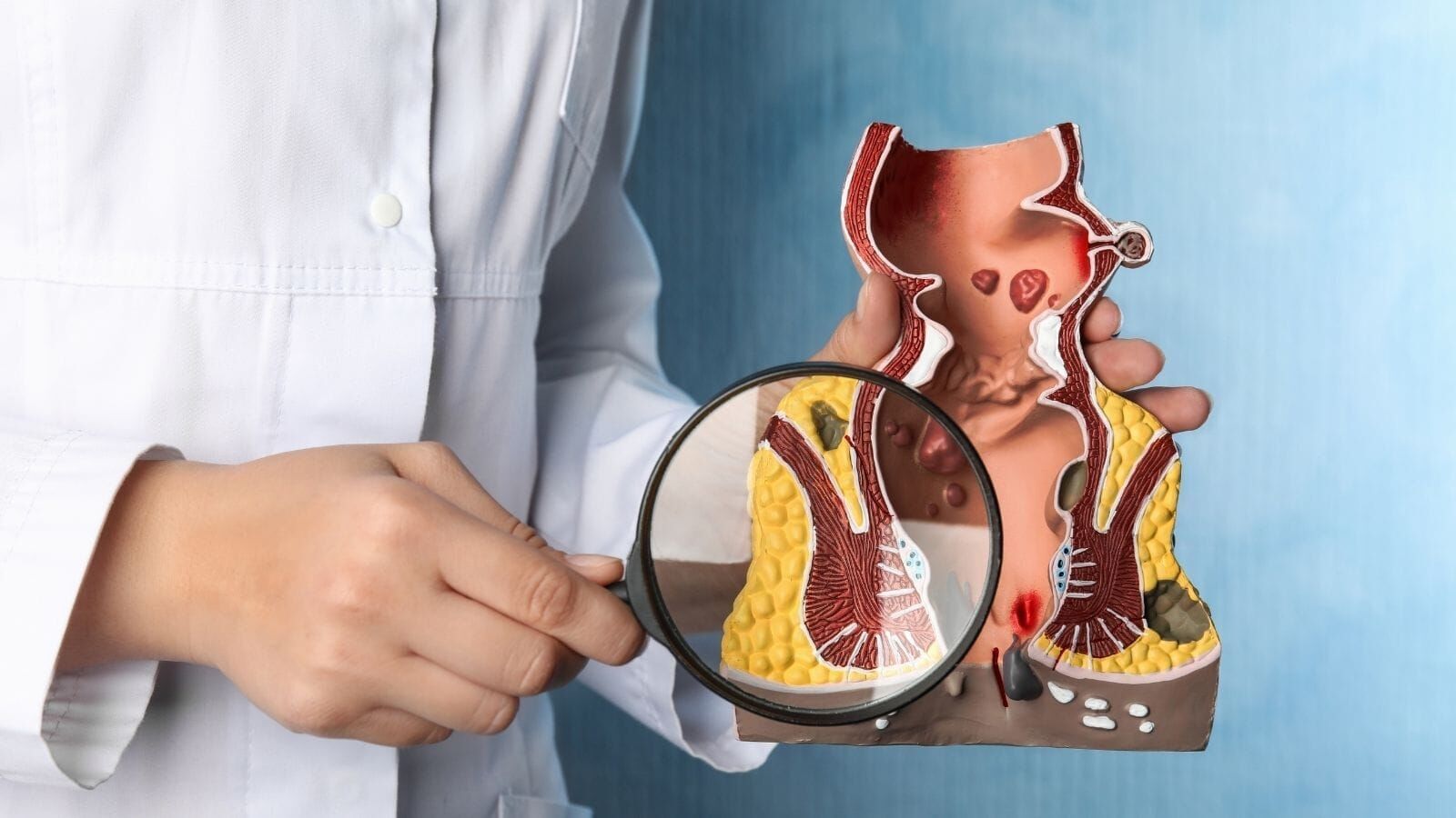 Hemoroid Tedavisinde Yeni Dönem! Kesi Ve Dikiş Gerektirmeyen Lazer Yöntemi Dikkat Çekiyor (2)