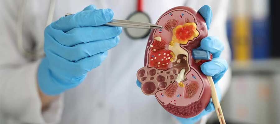 Böbreklerinizi Sessizce Tehdit Ediyor! Bu 3 Soruna Dikkat (1)