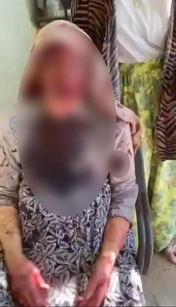 Genç Gazete Şanlıurfa’da 85 Yaşındaki Annesini Sopayla Darbetti! Şüpheli Tutuklandı (2)