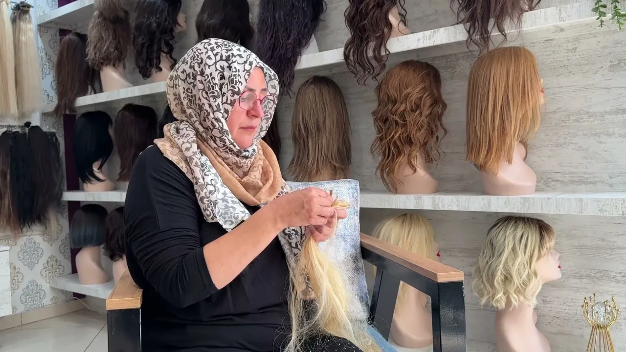 12 Yaşında Saçlarını Ve Kulaklarını Kaybetti, Şimdi Kadınlara Umut Oluyor (2)