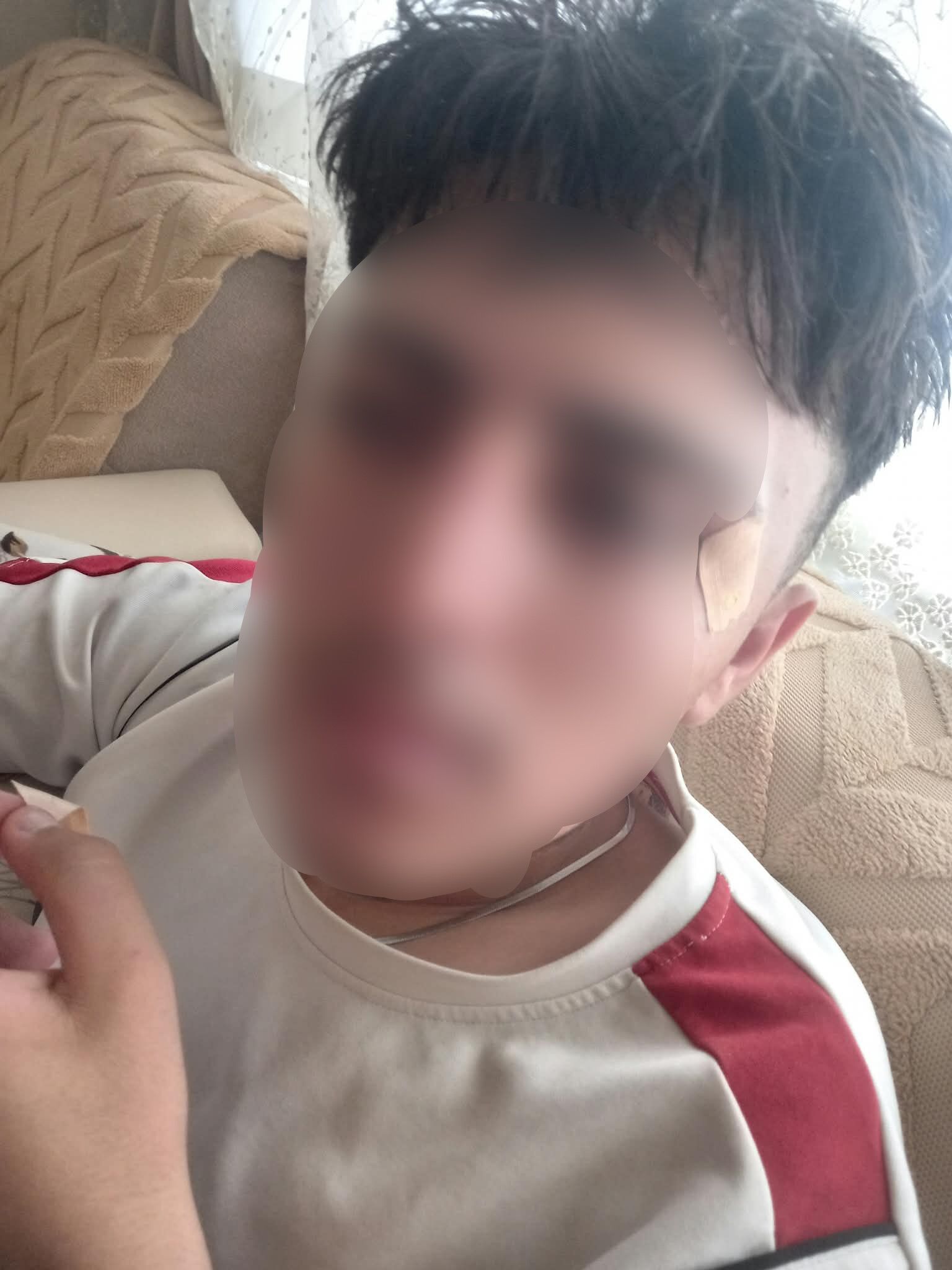 Öğretmenin Kafa Attığı 16 Yaşındaki Öğrencinin Burnu Kırıldı (1)