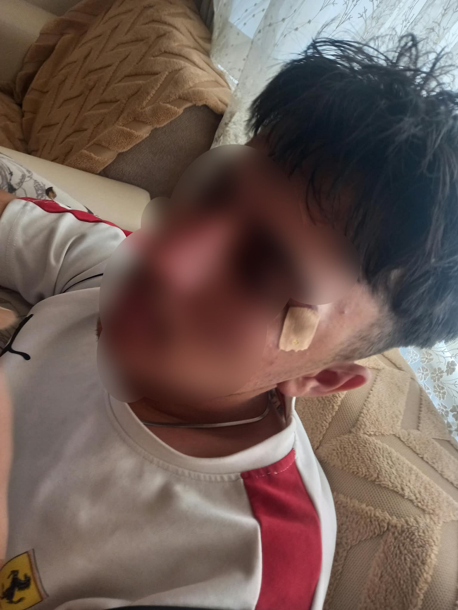 Öğretmenin kafa attığı 16 yaşındaki öğrencinin burnu kırıldı